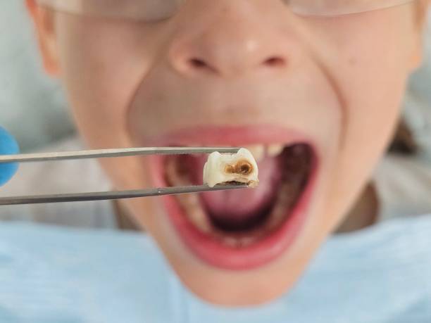 Best Tooth Infection Emergency Dentist  in Kenwood Estates, FL